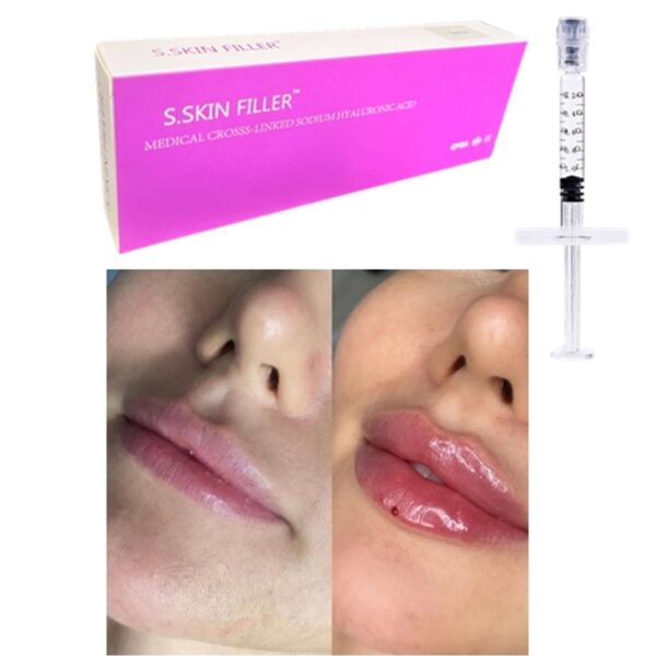 Biphasic S.SKIN FILLER - Image 2